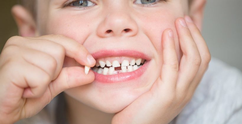 Denti da latte….questi sconosciuti. Il punto della loro importanza